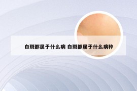 白斑都属于什么病 白斑都属于什么病种