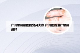 广州银屑病医院定问夫康 广州医院治疗银屑最好