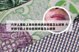 六岁儿童脸上有白色块状白斑是怎么回事 六岁孩子脸上有白色斑块是怎么回事