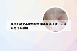 身体上起了小块的癣是咋回事 身上长一小块癣是什么原因