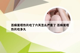 百癣夏塔热片吃了六天怎么严重了 百癣夏塔热片吃多久