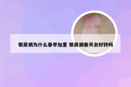 银屑病为什么春季加重 银屑病春天会好转吗