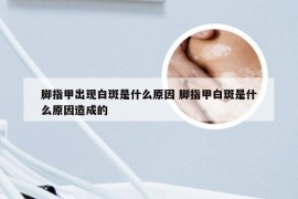 脚指甲出现白斑是什么原因 脚指甲白斑是什么原因造成的