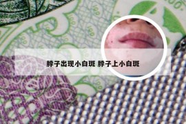 脖子出现小白斑 脖子上小白斑