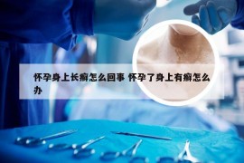 怀孕身上长癣怎么回事 怀孕了身上有癣怎么办