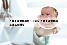 人身上经常长癣是什么原因 人身上经常长癣是什么原因呢