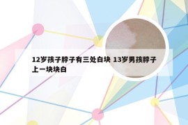 12岁孩子脖子有三处白块 13岁男孩脖子上一块块白