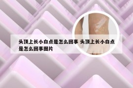 头顶上长小白点是怎么回事 头顶上长小白点是怎么回事图片