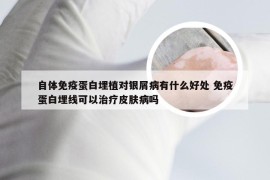 自体免疫蛋白埋植对银屑病有什么好处 免疫蛋白埋线可以治疗皮肤病吗