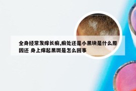 全身经常发痒长癣,癣处还是小黑块是什么原因还 身上痒起黑斑是怎么回事