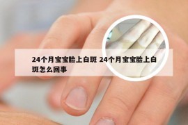 24个月宝宝脸上白斑 24个月宝宝脸上白斑怎么回事