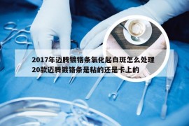 2017年迈腾镀铬条氧化起白斑怎么处理 20款迈腾镀铬条是粘的还是卡上的