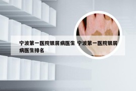 宁波第一医院银屑病医生 宁波第一医院银屑病医生排名