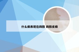 什么癣表现在四肢 四肢皮癣