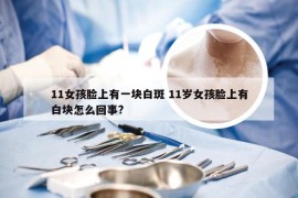 11女孩脸上有一块白斑 11岁女孩脸上有白块怎么回事?