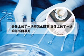 身体上长了一块癣怎么回事 身体上长了一块癣怎么回事儿