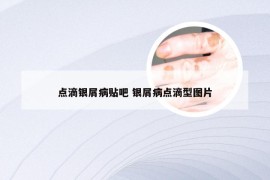 点滴银屑病贴吧 银屑病点滴型图片