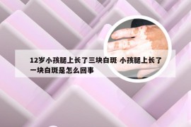 12岁小孩腿上长了三块白斑 小孩腿上长了一块白斑是怎么回事