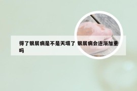 得了银屑病是不是天塌了 银屑病会逐渐加重吗