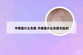 手癣是什么东西 手癣是什么东西引起的