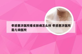 孝感惠济医院看皮肤病怎么样 孝感惠济医院是几级医院