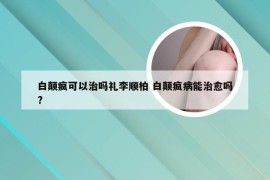 白颠疯可以治吗礼李顺柏 白颠疯病能治愈吗?