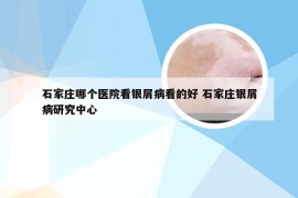 石家庄哪个医院看银屑病看的好 石家庄银屑病研究中心