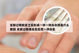 皮肤过敏脱皮之后形成一块一块白白斑是什么原因 皮肤过敏爆皮后出现一块白色