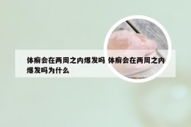 体癣会在两周之内爆发吗 体癣会在两周之内爆发吗为什么