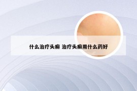 什么治疗头癣 治疗头癣用什么药好