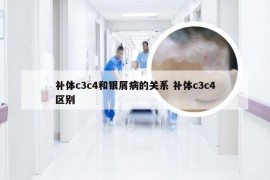 补体c3c4和银屑病的关系 补体c3c4区别