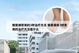 银屑病常用的3种治疗方法 银屑病有3种常用的治疗方法是什么