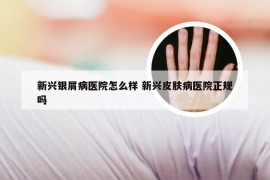 新兴银屑病医院怎么样 新兴皮肤病医院正规吗