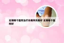 无锡哪个医院治疗白癜风效果好 无锡哪个医院好