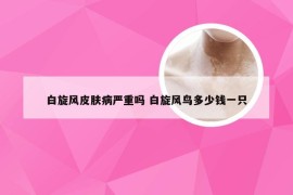 白旋风皮肤病严重吗 白旋风鸟多少钱一只