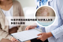 50多岁男性白斑是咋回事 50岁男人白发多是什么原因