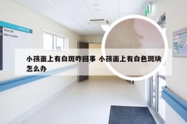 小孩面上有白斑咋回事 小孩面上有白色斑块怎么办