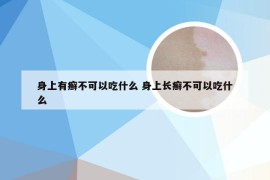 身上有癣不可以吃什么 身上长癣不可以吃什么