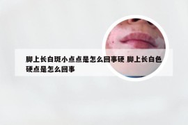 脚上长白斑小点点是怎么回事硬 脚上长白色硬点是怎么回事