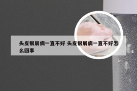 头皮银屑病一直不好 头皮银屑病一直不好怎么回事