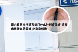 国内目前治疗银宵病打什么针剂疗效好 银宵病用什么药最好 北京京科治