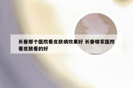 长春那个医院看皮肤病效果好 长春哪家医院看皮肤看的好