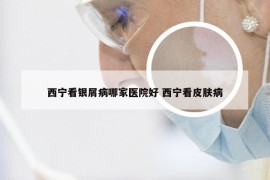 西宁看银屑病哪家医院好 西宁看皮肤病