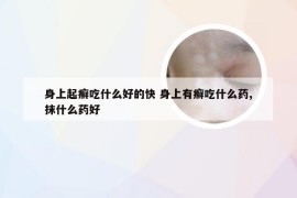 身上起癣吃什么好的快 身上有癣吃什么药,抹什么药好