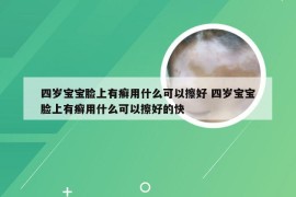 四岁宝宝脸上有癣用什么可以擦好 四岁宝宝脸上有癣用什么可以擦好的快