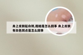 身上皮肤起白斑,粗糙是怎么回事 身上皮肤有白色斑点是怎么回事