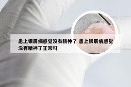 患上银屑病感觉没有精神了 患上银屑病感觉没有精神了正常吗