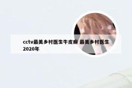 cctv最美乡村医生牛皮癣 最美乡村医生2020年