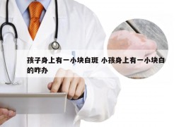 孩子身上有一小块白斑 小孩身上有一小块白的咋办