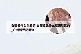 白颠是什么引起的 白颠疯是什么原因引起的_广州新世纪提议